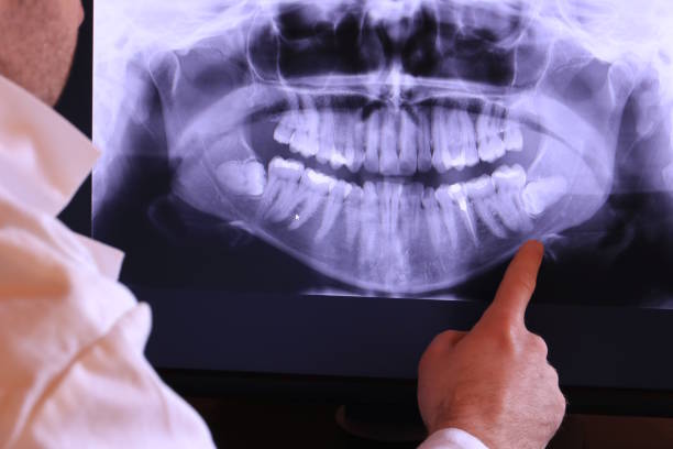 Best Same-Day Emergency Dental Services in Monongah, WV