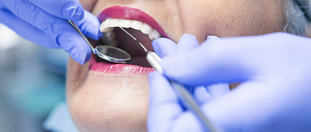 Best Emergency Tooth Extraction in Monongah, WV